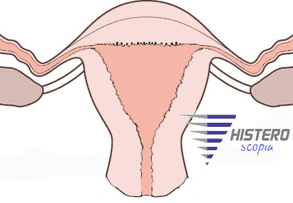 utero normal small